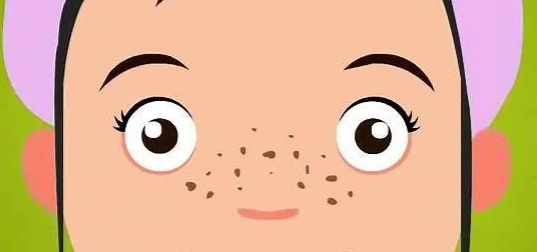 如何有效防斑减少皮肤上斑点的出现